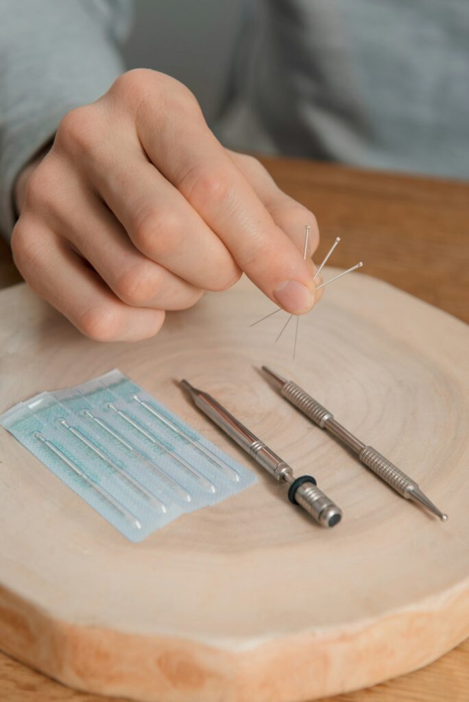 Acupuncture treatment on man's hands, needles.