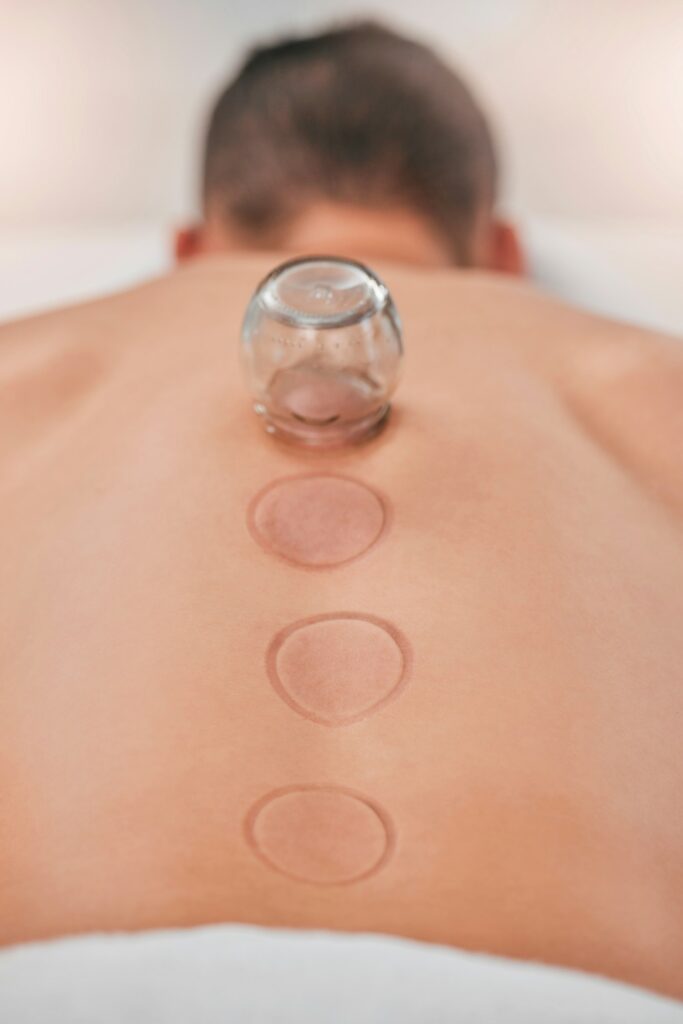 Wellness, man and cupping massage at spa for relief in stress, inflammation and back pain, healthca